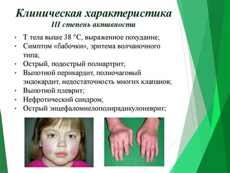 Системная красная волчанка - презентация онлайн