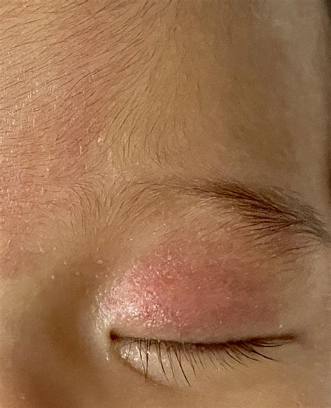Angel kiss on baby’s forehead and eyelid : r/newborns