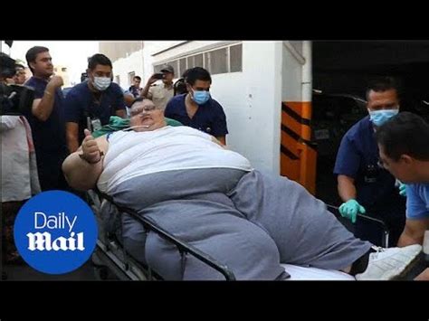 worlds heaviest man   kilos  undergo life saving surgery