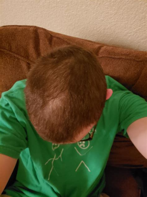 Am I going bald? : bald