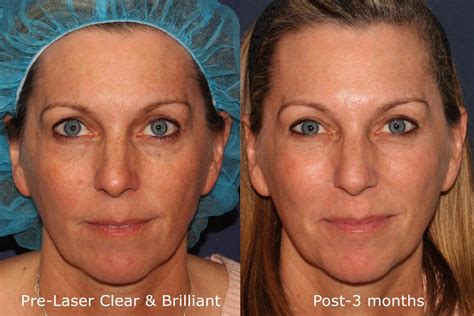 Postpartum Skincare and Rejuvenation - Cosmetic Laser Dermatology Skin ...