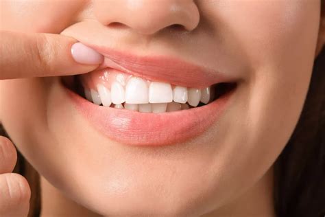 Дёсны. Большая российская энциклопедия
