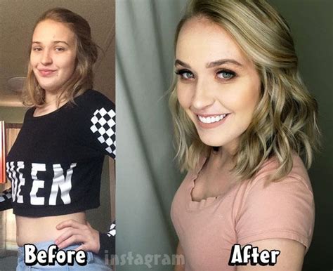 Mama June's daughter Anna Cardwell makeover before and after | Mama ...