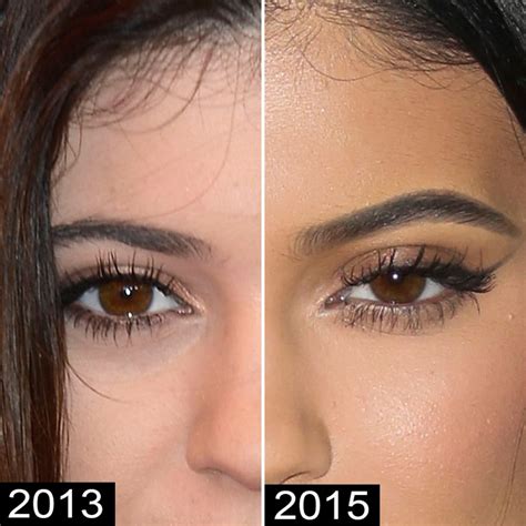 Plastic Surgery? See Kylie Jenner's Body Change Over Time | Life & Style