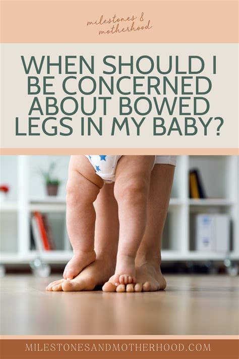 When Should I Be Concerned About Bowlegs? — Milestones & Motherhood