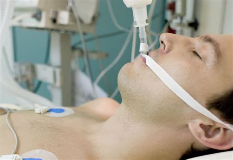 Coma: Types, Causes, Recovery