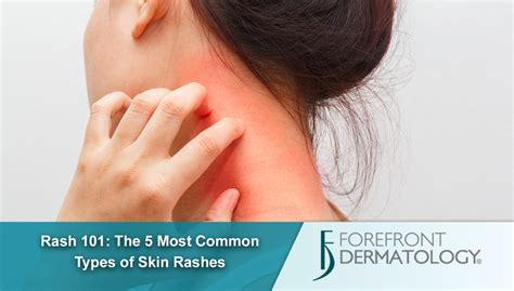 Rash 101: The 5 Most Common Types of Skin Rashes - DermSpecialists