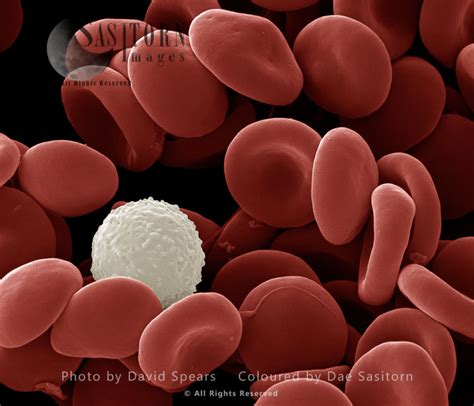 SEM: Human White and Red Blood Cells; Magnification x 12,000 at A4 ...