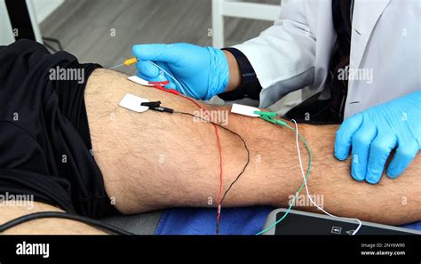 Electromyography EMG and Somatosensory Evoked Potential PEV of lower ...