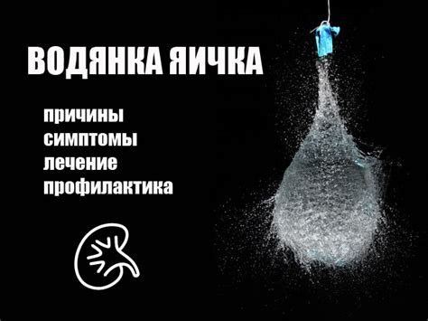 Водянка яичка - причины, симптомы, лечение | Урология Каменское