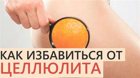 👉Как избавиться от целлюлита? 👍Лечение целлюлита 👍Процедуры, советы ...