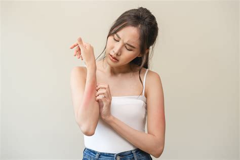 Pityriasis Rosea: Causes, Symptoms & How to Soothe Naturally