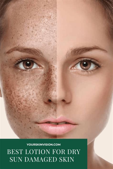 7 Best Lotion For Dry Sun Damaged Skin In 2024