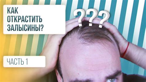 КАК ЗАРАСТИТЬ ЗАЛЫСИНЫ / Как остановить выпадение волос? [Часть 1 ...