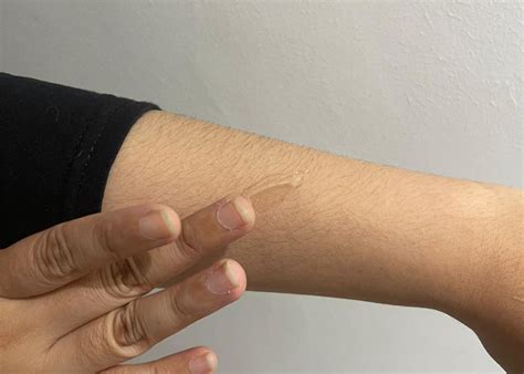 review bio oil dry skin gel honeykids asia