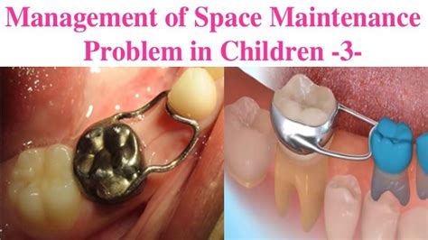 management  space maintenance problem  children youtube
