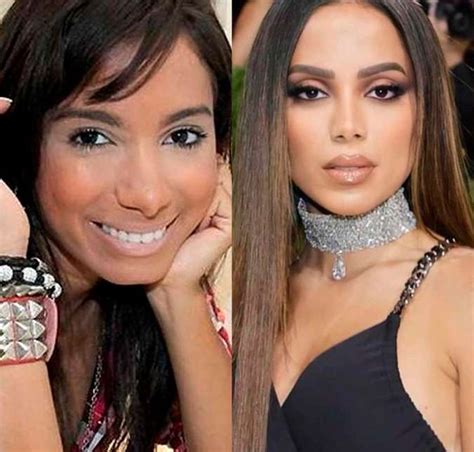 Antes E Depois Dos Famosos - Compare a aparência dos famosos antes e depois da fama - Estrelando