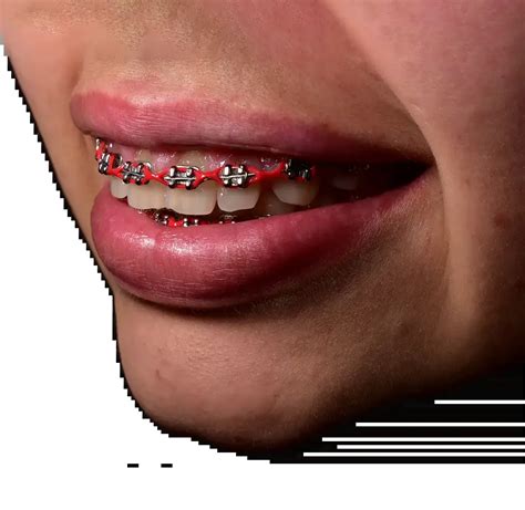 landing ortodoncia dr rojano clinica dental