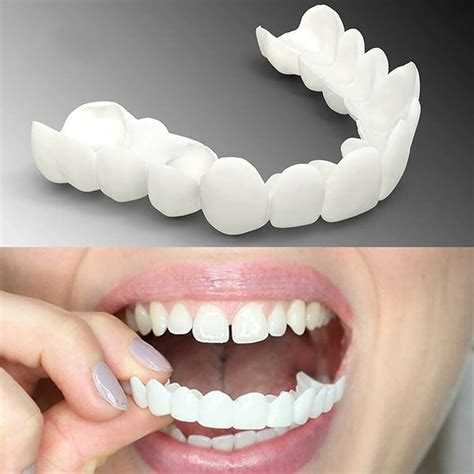 brigtviee lot de  paires de fausses dents malleables  clipser en haut