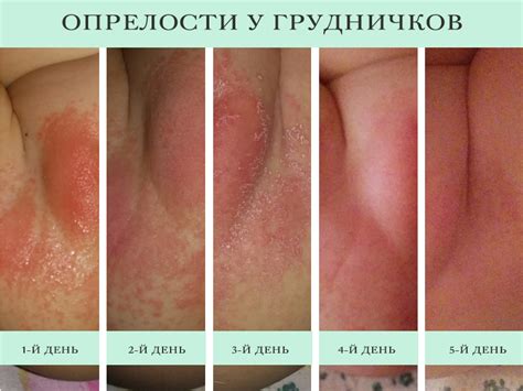 Обрив от пелена при новородени в свещеника (11 снимки): как да се ...