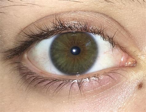 Central Heterochromia - i'm the princess | Fascinating Eyes | Pinterest ...