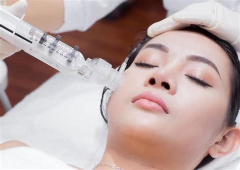 Acne treatment with Nano Skin technology: What you need to know | Vinmec