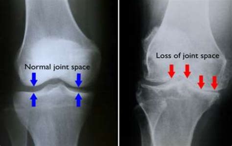 - PPS Physiotherapy