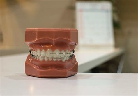 how to stop gum bleeding 4
