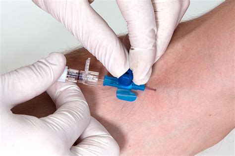 Intravenous Cannulation (IV) — Medistudents