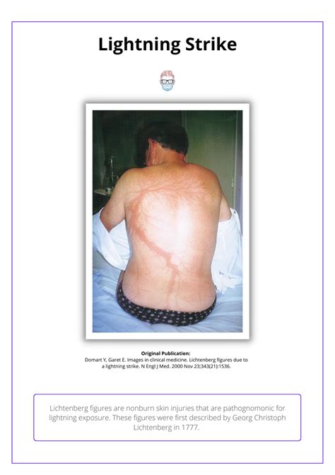 Electrical Burns Face