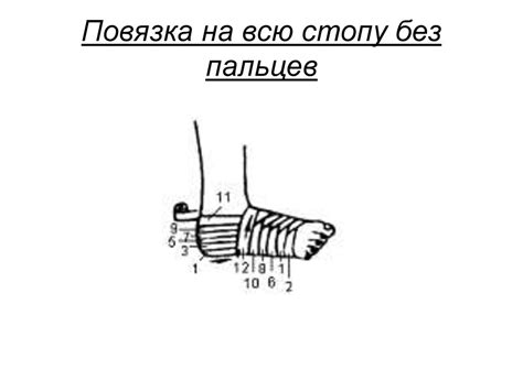 Десмургия. Виды повязок - презентация онлайн