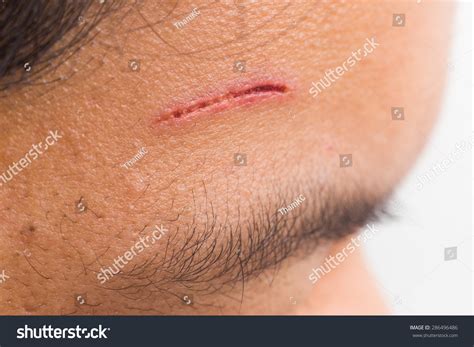 deep cuts  face