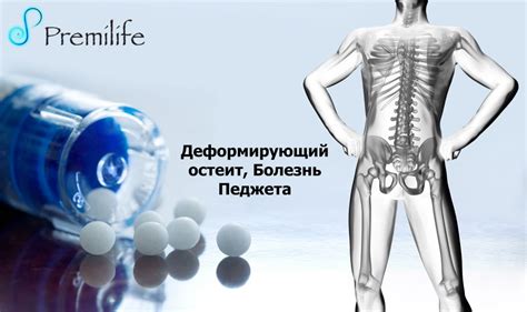 Остеит фото