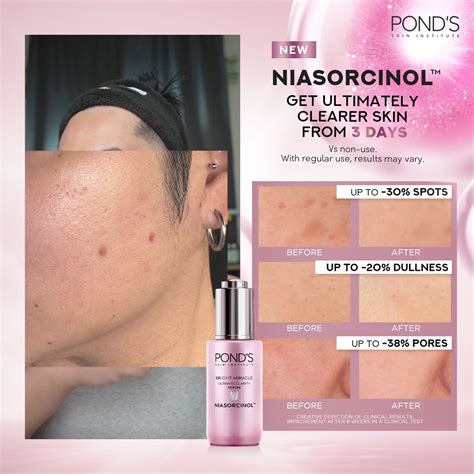 Introducing NEW POND'S Bright Miracle Serum with NIASORCINOL! | Get ...