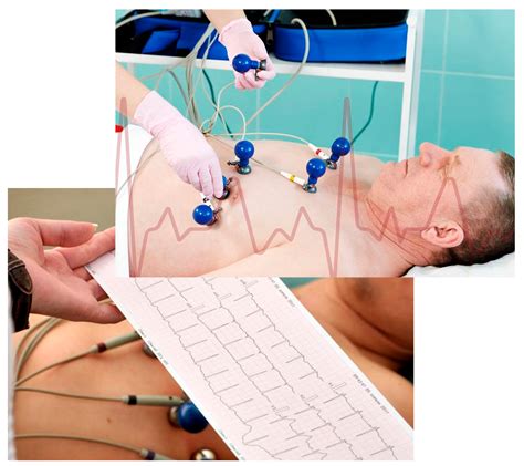 Como É O Exame De Eletrocardiograma - Eletrocardiograma | AClinica