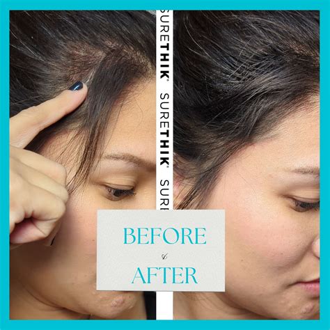 Surethik - Where Hair Dreams Become Reality! Witness the...