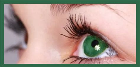 Olive Green Eyes Rare