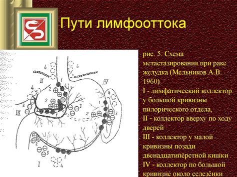 Рак желудка - презентация онлайн
