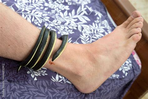 snake wrapped   man leg imitation   snake bite ketchup