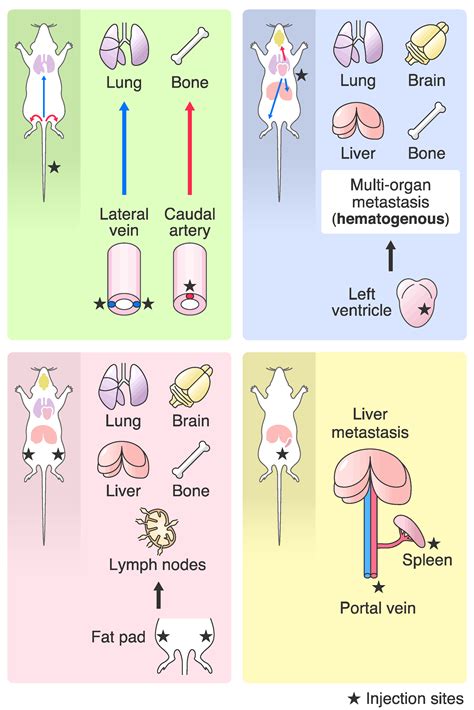 Intracardiac Injection Human