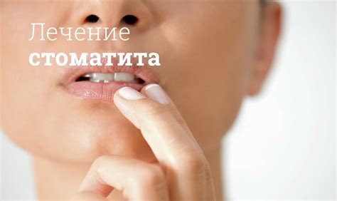 Стоматит во рту: как лечить у взрослых
