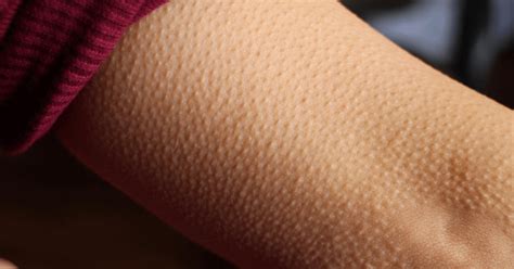 What is the Spiritual Meanings of Tingling Sensations