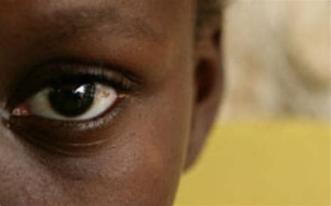 The Face of AIDS - Declan Henry Author