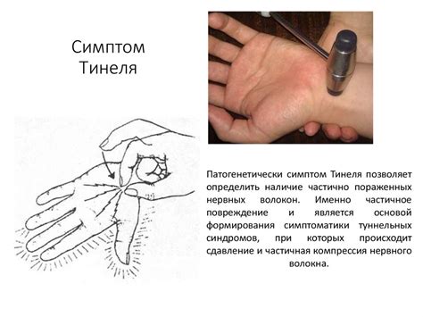 Шов нерва - презентация онлайн