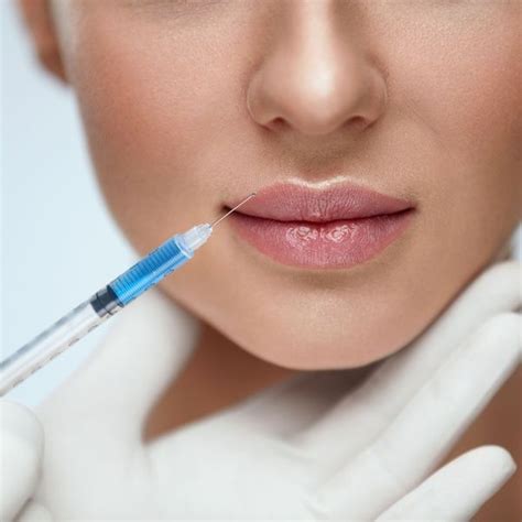 Russian Lip Flip or Filler at Injection Bar (Up to 68% Off) | Lip ...