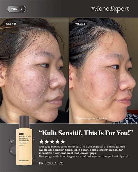 For Skin's Sake (FSS) | REAL PEOPLE, REAL RESULTS! Welcome to no
