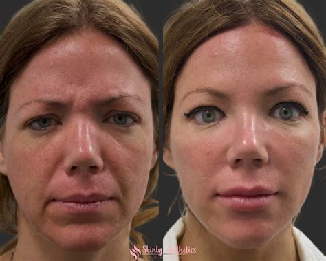 InfluencersGoneWild: Before & After Photos That Will STUN You - 63ffj6c