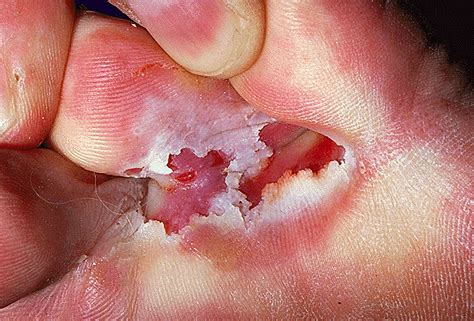 Why a 112/28 reading is surprisingly common in top athletes 8