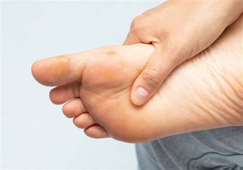 seed corn   foot understanding    symptoms