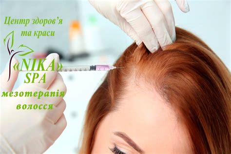 Мезотерапія волосяної шкіри голови | Nika Spa
